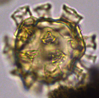 Hystrichosphaeridium tubiferum 3 HtuR27X35050235975c.jpg